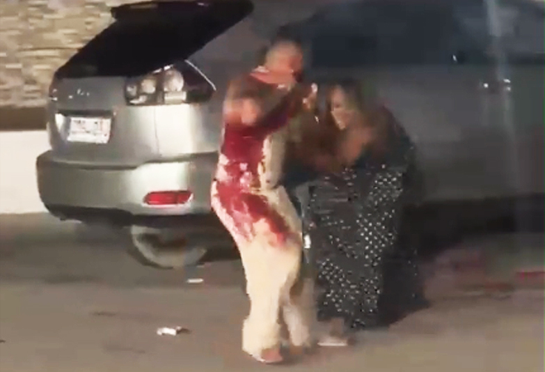 Un joven resulta herido grave tras una agresión con arma blanca en la playa del Arenal