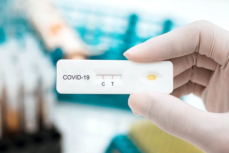 Los test de antígenos de autodiagnóstico llegan a las farmacias